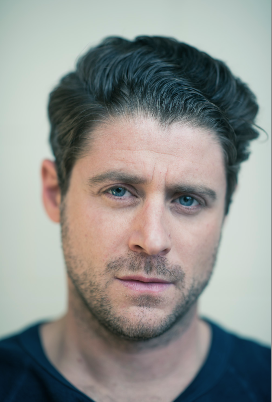 Scary Movie’s Jon Abrahams Gets Fractured